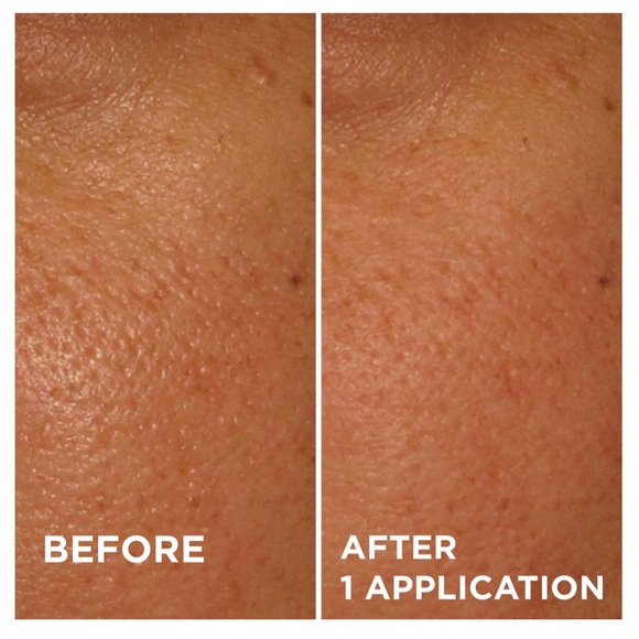 NIB Dr. Brandt PoreDermabrasion Pore Exfoliator - Picture 2 of 16